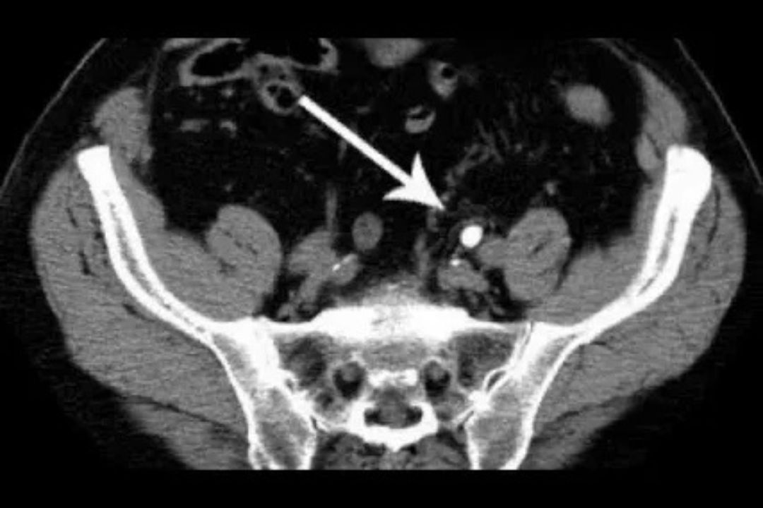 A clinician viewing a CT scan image on a computer monitor in a radiology reading room