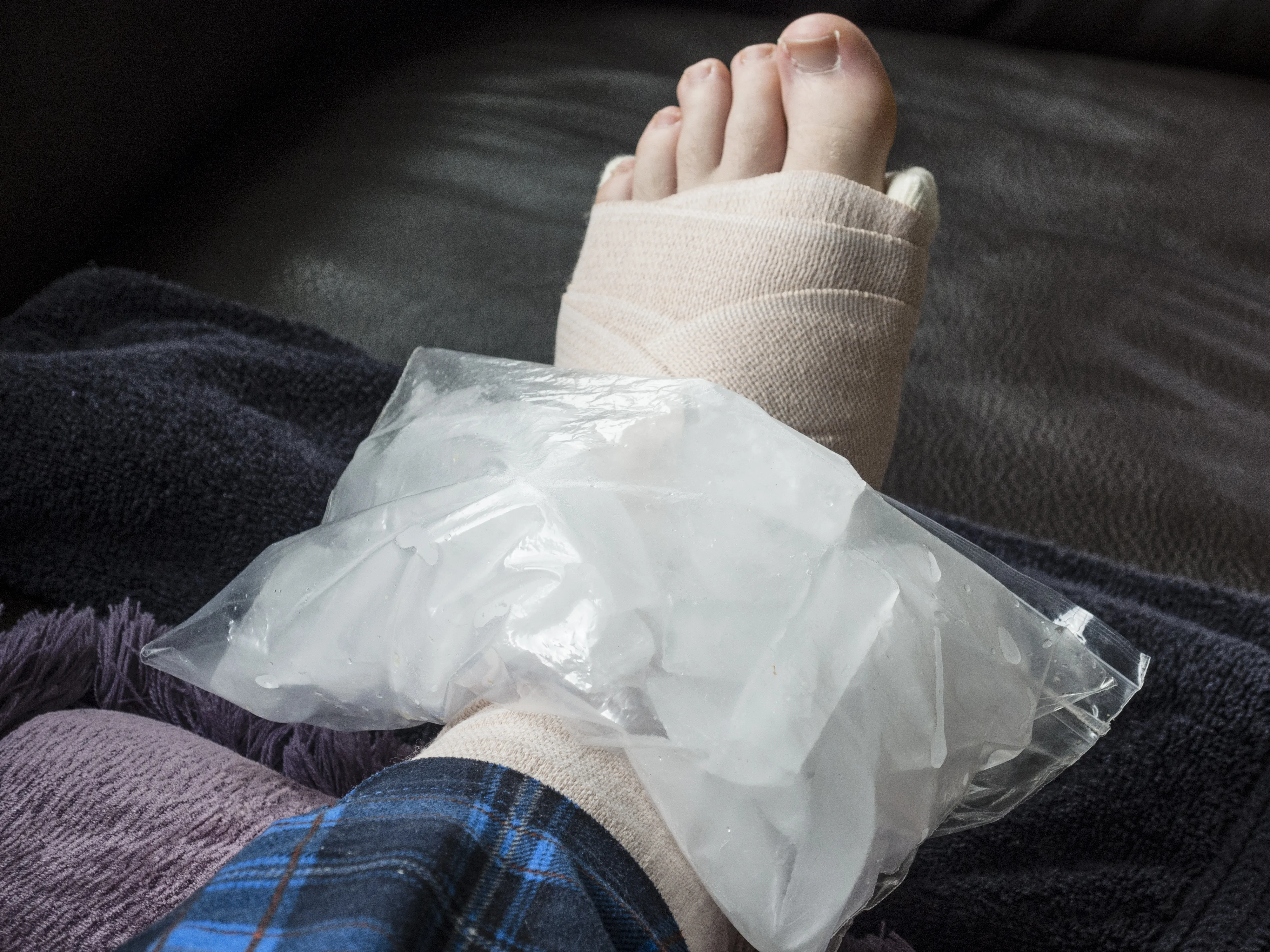 A person seated on a couch with their ankle elevated on a pillow while holding a flexible ice pack around the outside of the ankle in a home setting