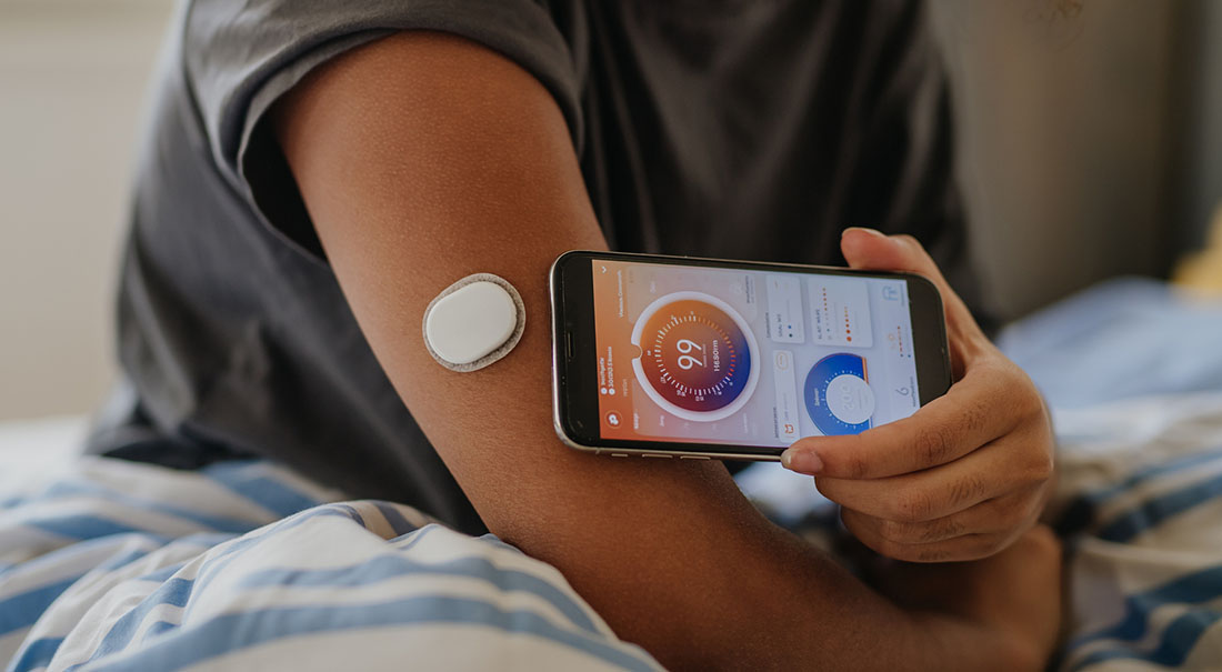 A person wearing a continuous glucose monitor sensor on the back of their upper arm while holding a smartphone